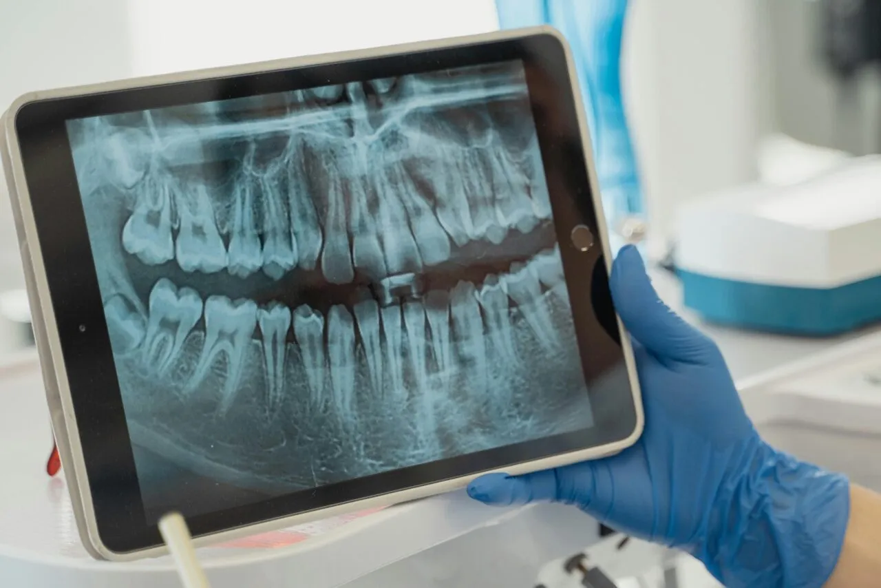 Periodontologia